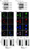 FOXM1 is required for formation of the nuclear SMAD3/SMAD4 complex.