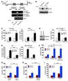 FOXM1 regulates TGF-β–induced invasion by affecting TIF1γ-mediated inhibiti