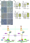 FOXM1 expression significantly correlates with activated TGF-β signaling in