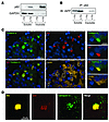 Insoluble p62-sequestered IAPP is targeted for lysosomal degra