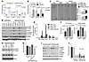 ZEB1 activates p110α through an EGFR/ERBB2 autocrine loop.