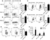 Short life-span of MDSCs contributes to their expansion.