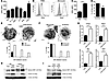 ER stress response drives TRAIL-R upregulation in MDSCs.