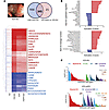 Gene expression signature and biologic pathways associated wit