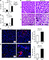 Hepatic injury in HFD-fed ketogenesis-insufficient mice.