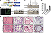 Oncogenic role of NCoA2 in PIN.