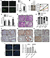 Upregulation of NCoA2 during androgen deprivation is critical