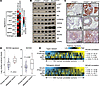 NCoA2 activates PI3K/AKT and MAPK signaling in PCa.