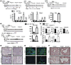 NCoA2 directly regulates key components of PI3K/AKT and MAPK p