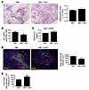 SEA immunization increases susceptibility to Mtb infection.