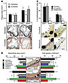 Increased in-stent stenosis in Gpx1–/– Apoe–/– mice is reverse