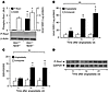 GPX1 deletion–dependent reductive stress activates ROS1.