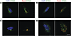 Intracellular localization of p.V155M STING.