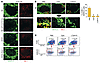 Defective LTβR signaling is associated with decreased expression of MKL1 in