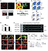 Deficiency of MKL1 is associated with defective F-actin polymerization and