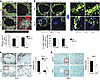 Follicular translocation of MZ B cells and decreased expression of MKL1 in