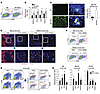 Disruption of the MKL1/SRF mechanosensing pathway leads to autoantibody pro