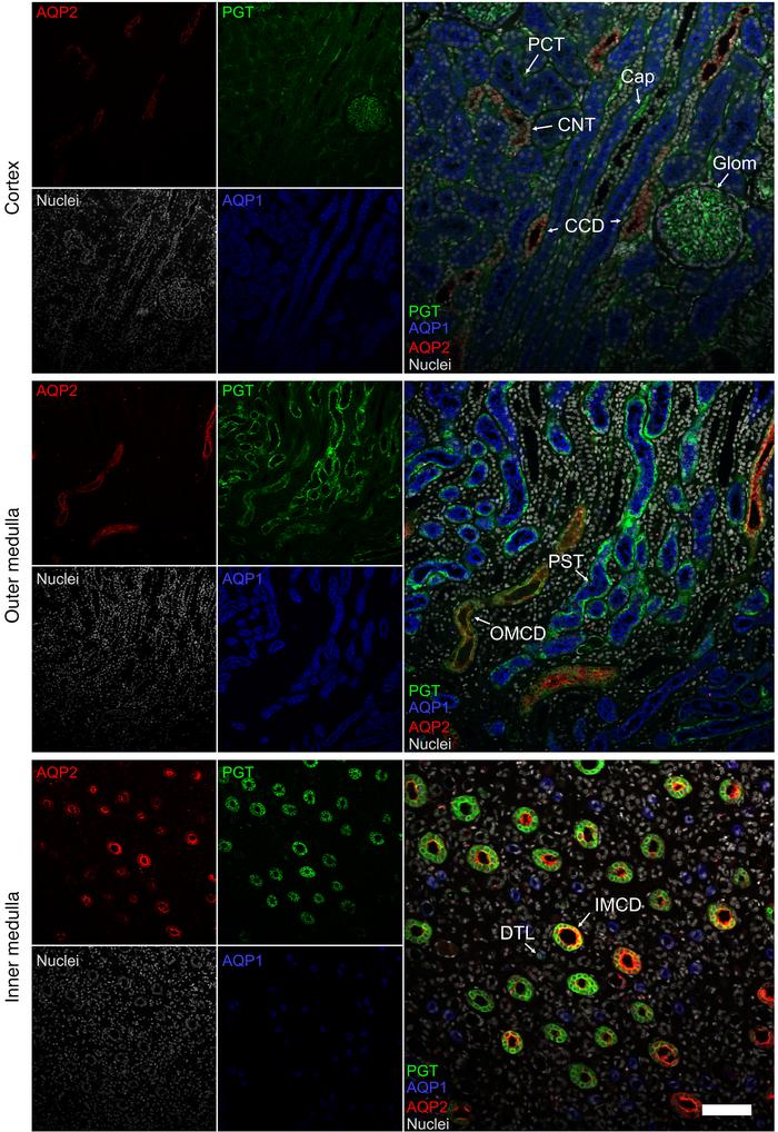 Renal expression of SLCO2A1 and colocalization with AQP1 and AQP2.
Repre...