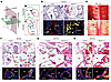 Hdac3 is an important regulator of lymphovenous valve development.