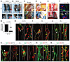 Hdac3 deficiency causes impaired lymphatic drainage and anomalous lymphatic