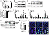 UmodC147W/+ kidneys activate ER stress, innate immune response, and apoptot