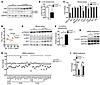 UmodC147W/+ kidneys are deficient in autophagy.