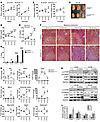 Time course reveals a pattern of disease progression in UmodC147W/+ mice.