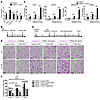 Silencing of TRIB3 in primary human renal epithelial cells rescues them fro