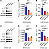 MYC is necessary for activation of the IRE1/XBP1 pathway.