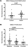 DMGV levels are elevated in biopsy-proven NASH and are modulated following