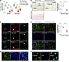 Expression of NEXN and NEXN-AS1 in atherosclerotic plaques.