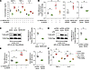 NEXN-AS1 and NEXN suppress the TLR4/NF-κB pathway and inflammatory gene exp