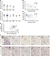 HIV is present in the brains of systemically infected BLT mice.