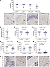 Human T cells are sufficient to establish HIV infection in the brain.