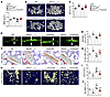 Transgenic overexpression of bmncr alleviated bone loss and marrow fat accu