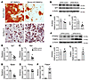 Bmncr promoted osteogenic differentiation and inhibits adipogenic different