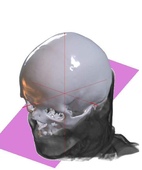 Example mesh from CT scan of a human header