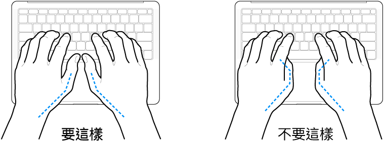 雙手置於鍵盤上,分別顯示正確與不正確的大腿姿勢。