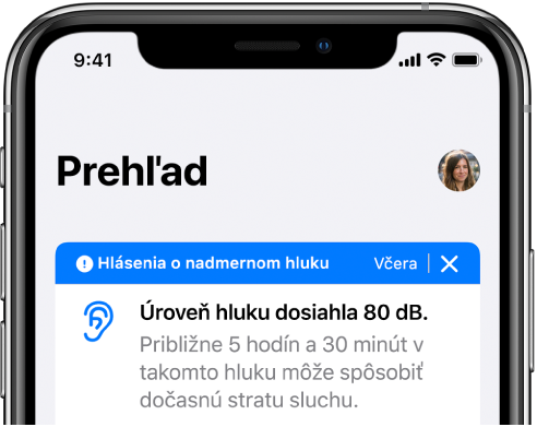 Obrazovka Zhrnutie s profilovým obrázkom vpravo hore.