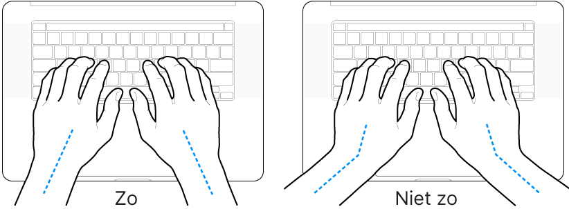 Handen boven een toetsenbord, waarbij de goede en verkeerde stand van de handen en polsen wordt aangegeven.