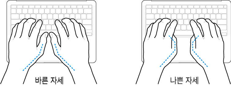 엄지손가락의 바른 위치와 잘못된 위치를 보여주는 키보드 위의 손.