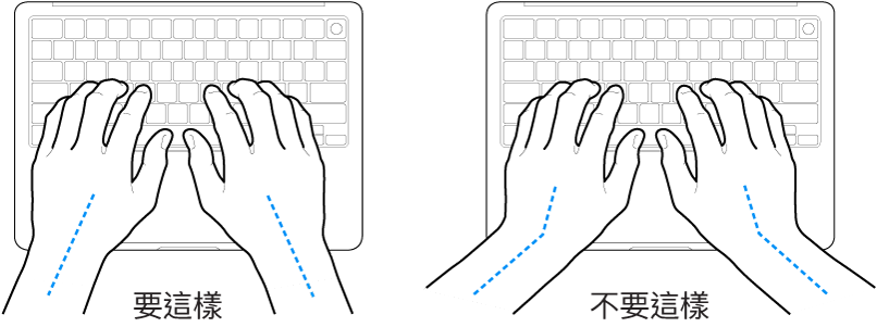 雙手置於鍵盤上,分別顯示正確與不正確的手肘與雙手對稱擺放位置。