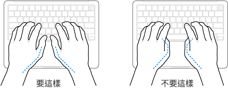 雙手置於鍵盤上,分別顯示正確與不正確的大腿姿勢。
