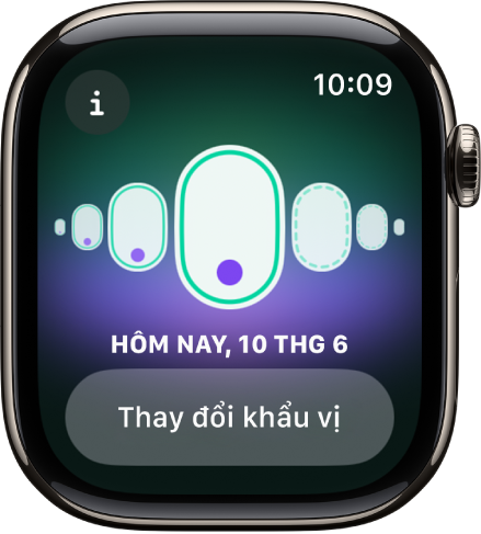 Một màn hình Theo dõi chu kỳ.