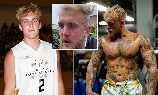 Jake Paul sparks steroid suspicions among doctors after photo of star with bad face acne