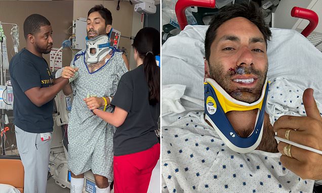 Catfish star Nev Schulman breaks his neck in terrifying accident when his motorcycle