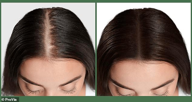 The ProVia two-step system is suitable for both men and women, no matter what the cause of their hair thinning or hair loss