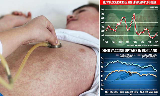 Revealed: Little-known 'first' sign of deadly measles that's 'often missed' - would you