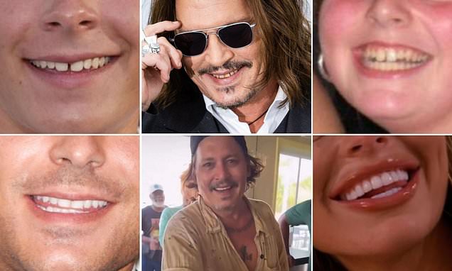 Dental experts reveal the most astonishing celeb teeth transformations - but can you tell