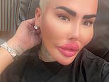 Revealed: Mother, 33, who died after non-surgical BBL was treated at UK beauty clinic run by TV star dubbed the 'Lip King'